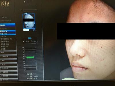 皮膚檢測儀哪家強？Visia、美圖宜膚、A-one實測深度對比